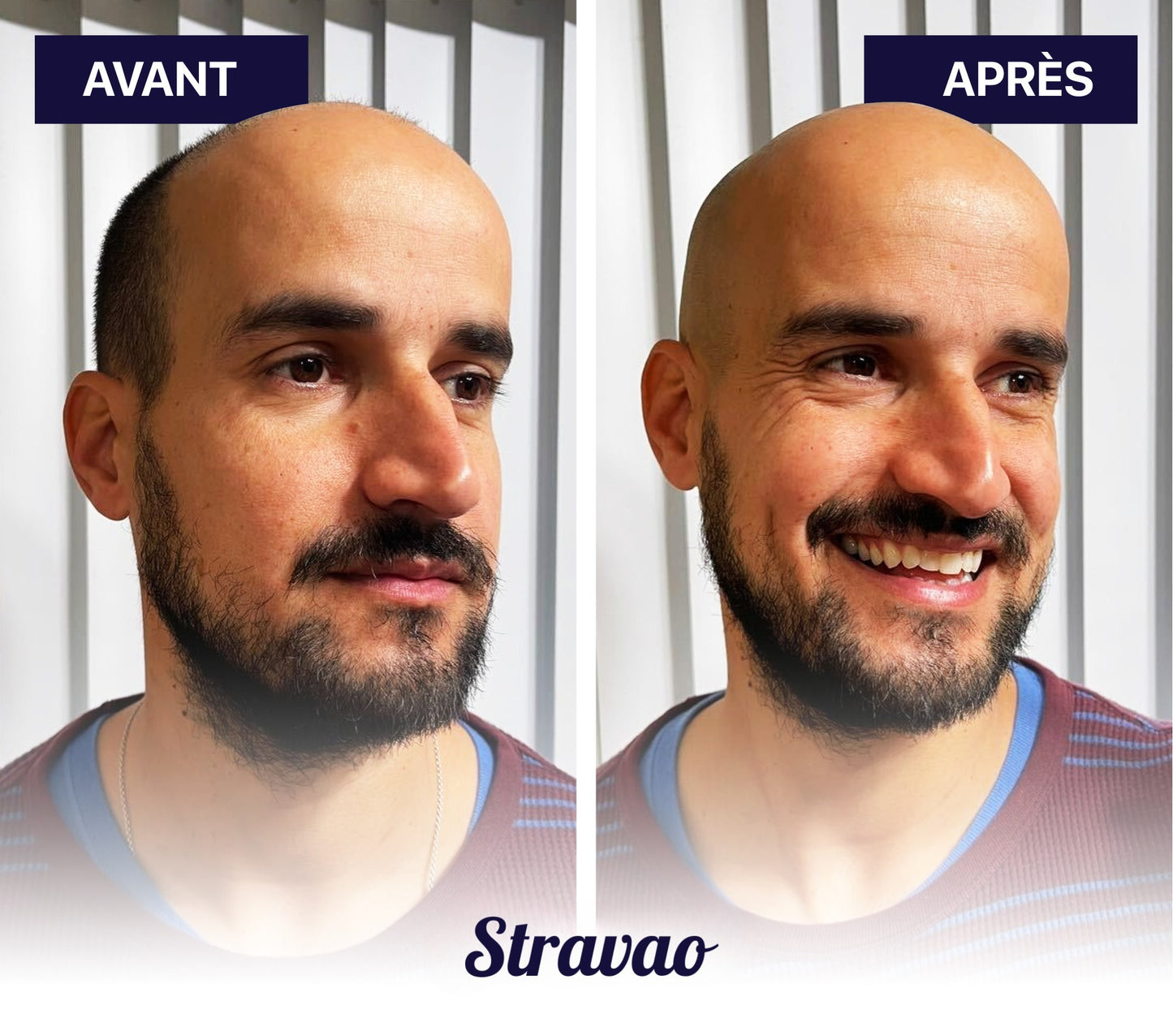 FlexSeries - Un rasage sans effort, en 3 minutes chrono !